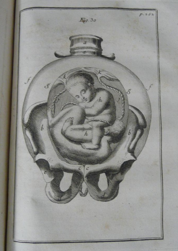 L'art médical de l'accouchement au XVIIIe siècle